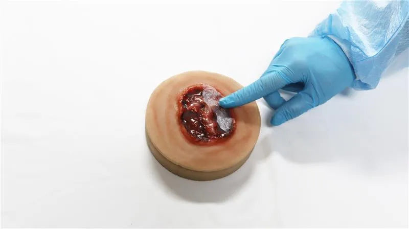 Decubitus Ulcer Stage 4 Task Trainer