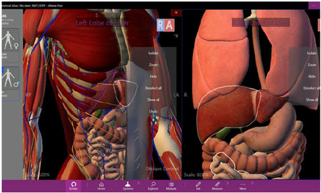 3D Digital Anatomy Table | Medical-X – Medical-x