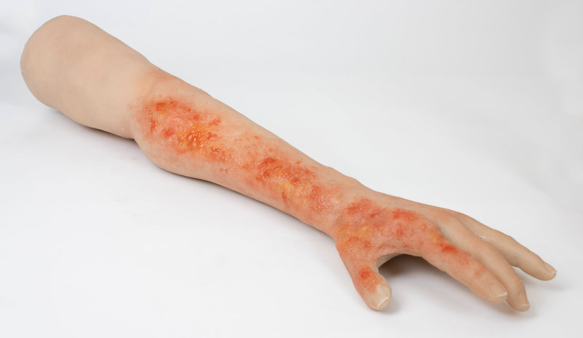 Arm with Burn Wound Task trainer