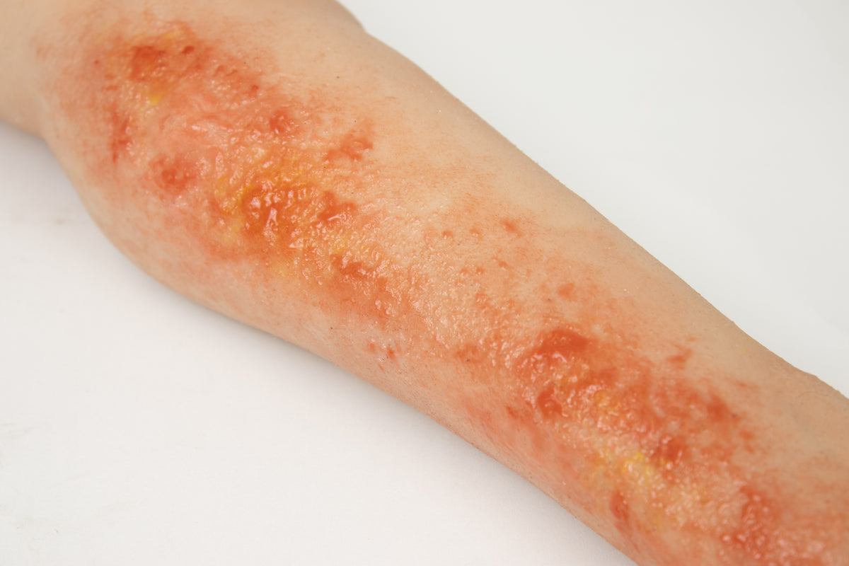 Burn wound task trainer