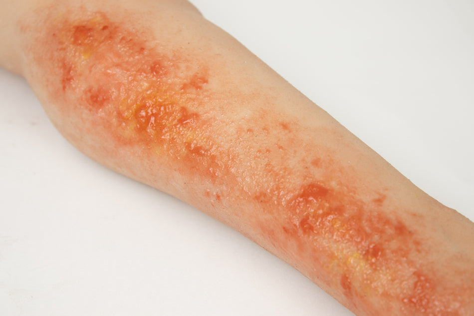 Burn wound task trainer