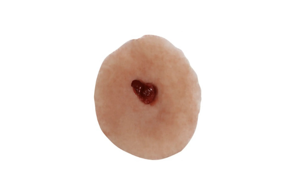 Gunshot Entrance Wound Medium