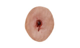 Gunshot Entrance Wound Small