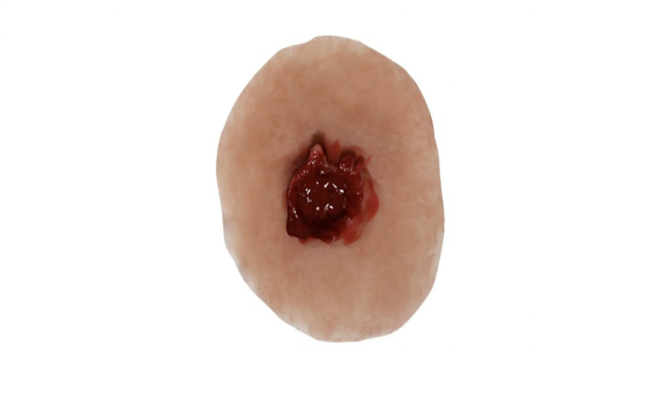 Gunshot Exit Wound Medium