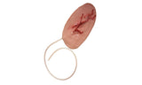 Multiple Incised Bleeding Wound