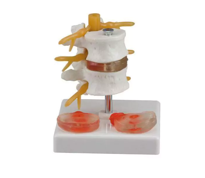 Spine model